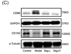 NLRP3 Antibody - Figure 6 Effects of stigmasterol on aortic macrophage and SMC phenotype in ApoE−/− mice.