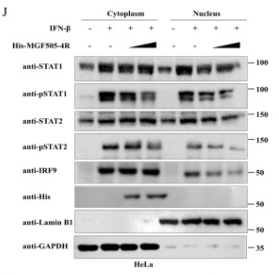 Phospho-STAT1 (Tyr701) Antibody - Figure 9.