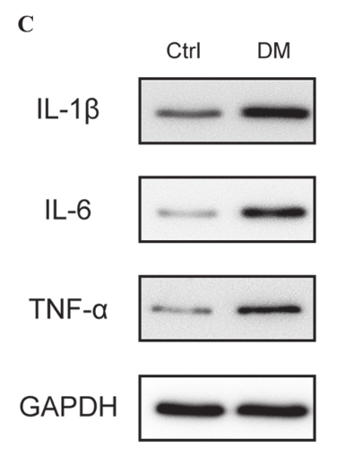 TNF alpha Antibody - Figure 5: Inflammatory factors and epidermal thickness in chronic diabetic ulcers.