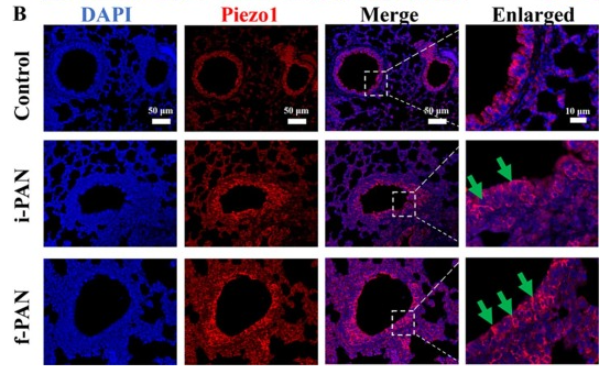Piezo1 Antibody - Fig.