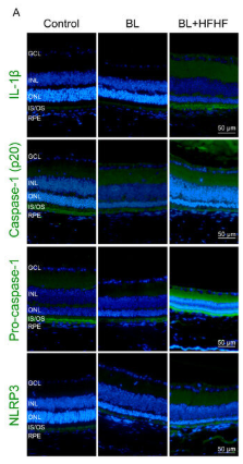 Caspase 1 Antibody - Figure 6.