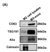 Calnexin Antibody - FIGURE 3 M2-like macrophage-derived exosomes enhance non-small-cell lung cancer (NSCLC) cell migration and invasion.