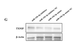 TXNIP Antibody - Fig.