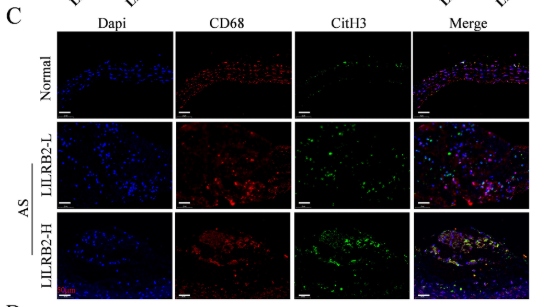 CD68 Antibody - FIGURE 9 Atherosclerotic arterial tissues exhibiting upregulated LILRB2 expression are associated with enhanced PI3K/AKT signaling pathway activation and MET formation.