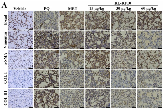 Vimentin Antibody - Fig.