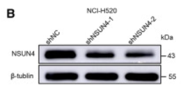 Tubulin beta Antibody - Figure 2 NSUN4 promotes the growth of human LUSC cells (A and B) RT-qPCR and western blot analysis of NSUN4 knockdown efficiency in NCI-H520 and NCI-H226 cells.