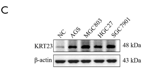 Keratin 23 Antibody - Figure 2 The expression of KRT23 in GC cells.