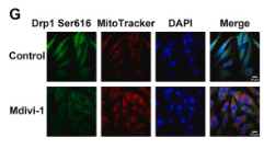 Phospho-DRP1 (Ser616) Antibody - Fig.