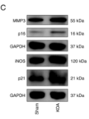 MMP3 Antibody - Figure 1 - Impaired mitochondrial autophagy and enhanced cell senescence in KOA cartilage.