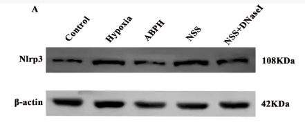 NLRP3 Antibody - FIGURE 8 Relative protein expression levels of NLRP3 (A,B), ASC (C,D), caspase-1, and caspase-1-p20 (E,F),.