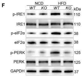 IRE1 Antibody - Fig.