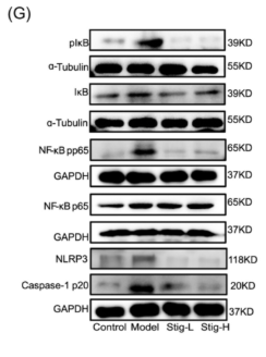 Cleaved-Caspase 1 (Asp296), p20 Antibody - Figure 6 Effects of stigmasterol on aortic macrophage and SMC phenotype in ApoE−/− mice.