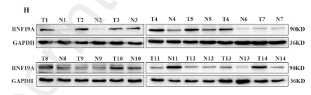 RNF19A Antibody - Fig.
