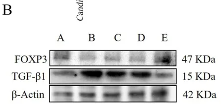 TGF beta 1 Antibody - Figure 5 (A) Correlation analysis of intestinal flora and bile acid metabolism.