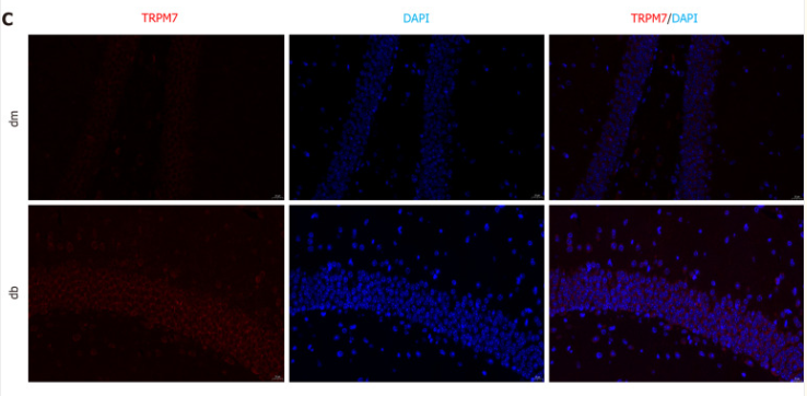 TRPM7 Antibody - Figure 3.
