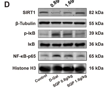 IKB alpha Antibody - FIGURE 9 Impact of SQP on cellular senescence and the SIRT1/NF-κB pathway in GC-1spg cells.