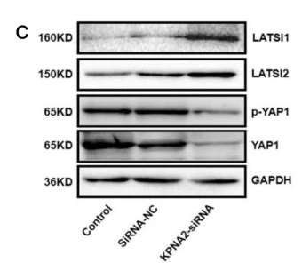LATS1/2 Antibody - Figure 3 The impact of KPNA2 on the YAP/TAZ pathway.