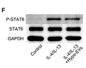 Phospho-STAT6 (Tyr641) Antibody - Figure 7 CAV-1 inhibited the expression of p-STAT6.