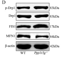 Phospho-DRP1 (Ser616) Antibody - Fig.