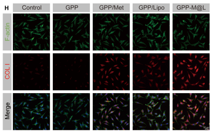 Collagen I Antibody - Fig.