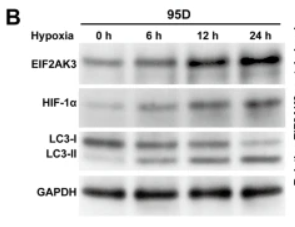 PERK Antibody - Fig.