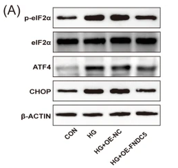 Phospho-eIF2 alpha (Ser51)[Ser52] Antibody - Fig.