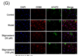 CD68 Antibody - Figure 4 Effects of stigmasterol on lipid metabolism and phenotype change in ox-LDL-treated SMCs.