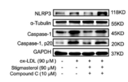 Caspase 1 Antibody - Figure 3 Stigmasterol inhibits macrophage phenotypic transition to pro-inflammatory type by influencing the AMPK/NF-κB/NLRP3 pathway.