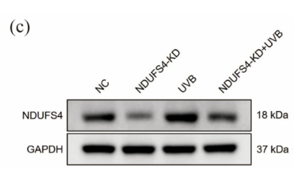 GAPDH Antibody - NDUFS4 expression is regulated by the ultraviolet ray in the cell damage induced by ultraviolet light.