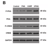 PKA alpha/beta/gamma CAT Antibody - Fig.