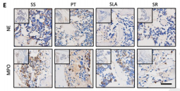 Neutrophil Elastase Antibody - Fig3.