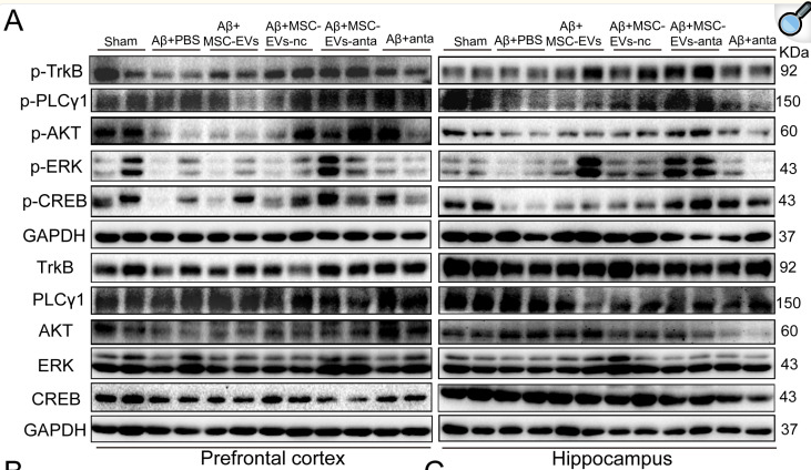 Phospho-Trk B (Tyr706) Antibody - Figure 6.