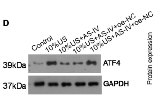 ATF4 Antibody - Figure 3.