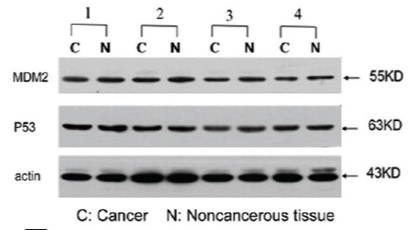 p53 Antibody - Figure 4 Inhibition of MDM2 switches pyroptosis to apoptosis in A549 and GSDME-overexpressing HBE cells.