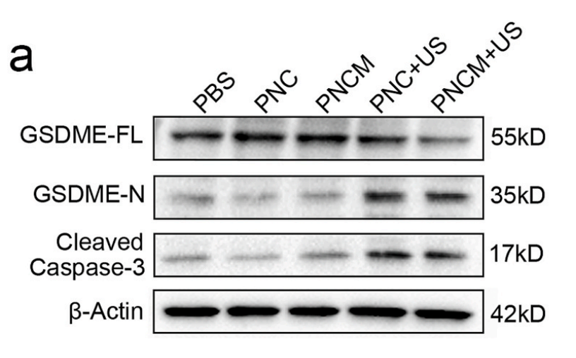 Cleaved-DFNA5/GSDME Antibody - N-terminal - Fig.
