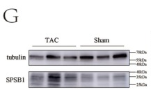 Tubulin beta Antibody - FIGURE 2.