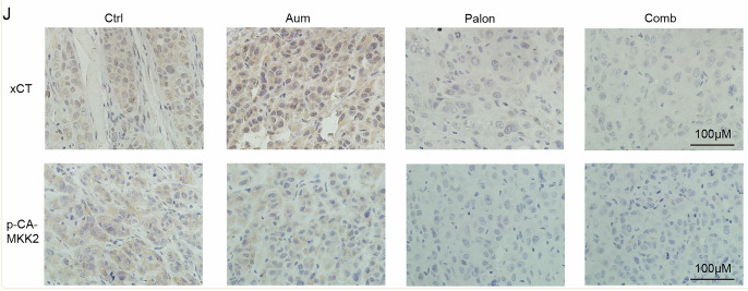 Phospho-CaMKK2 (Ser511) Antibody - Figure 6.