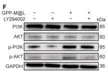 PI3K p85 alpha Antibody - Fig.