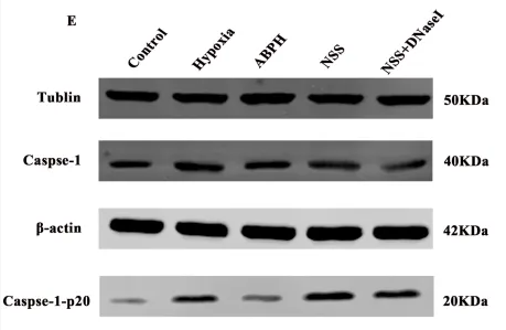 Caspase 1 Antibody - FIGURE 8 Relative protein expression levels of NLRP3 (A,B), ASC (C,D), caspase-1, and caspase-1-p20 (E,F),.