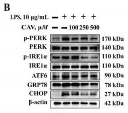 Phospho-IRE1 (Ser724) Antibody - Figure 5.