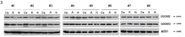 GSDMD Antibody - Figure 1 Expressions of GSDMD and GSDME in human lung tissues and cell lines.