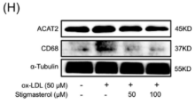 CD68 Antibody - Figure 4 Effects of stigmasterol on lipid metabolism and phenotype change in ox-LDL-treated SMCs.