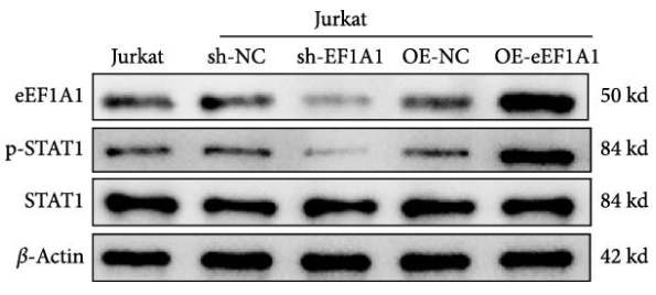 STAT1 Antibody - Figure 6 (c) Functional impact of EEF1A1 on T cell signaling and differentiation in SLE.