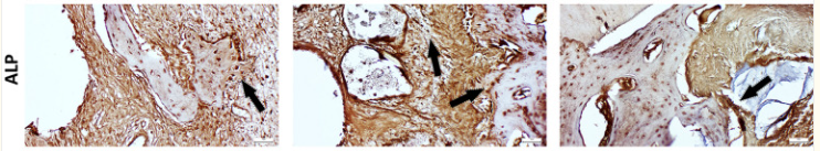 Alkaline Phosphatase Antibody - Fig.
