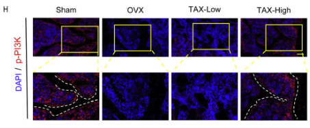 Phospho-PI3K p85 alpha (Tyr607) Antibody - Fig.