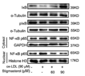 Phospho-IKB alpha (Ser32/Ser36) Antibody - Figure 3 Stigmasterol inhibits macrophage phenotypic transition to pro-inflammatory type by influencing the AMPK/NF-κB/NLRP3 pathway.