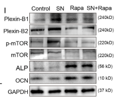 Osteocalcin Antibody - FIGURE 5 Sema4D inhibited osteoblast differentiation via Plexin-B/mTOR signalling.