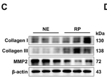 beta Actin Antibody - Figure 1.