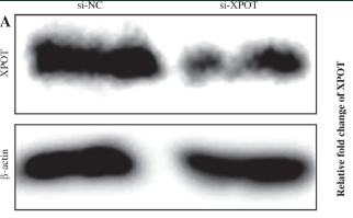 Exportin T Antibody - Fig.