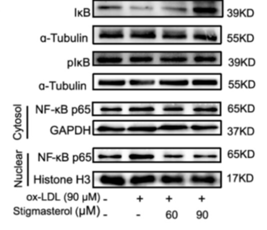IKB alpha Antibody - Figure 3 Stigmasterol inhibits macrophage phenotypic transition to pro-inflammatory type by influencing the AMPK/NF-κB/NLRP3 pathway.